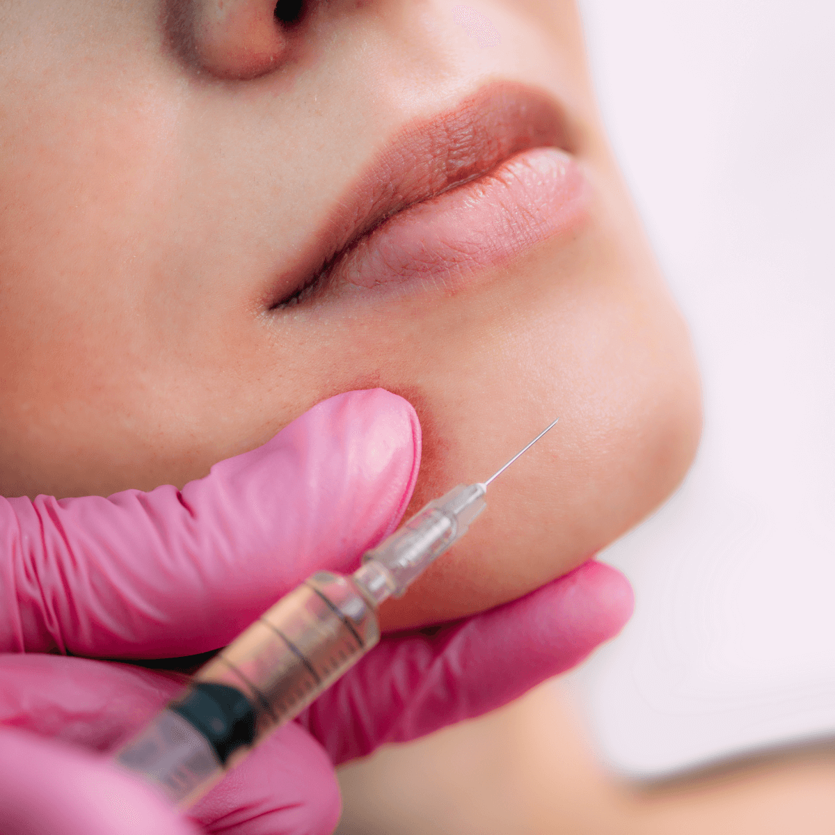 woman getting a dermal filler injection