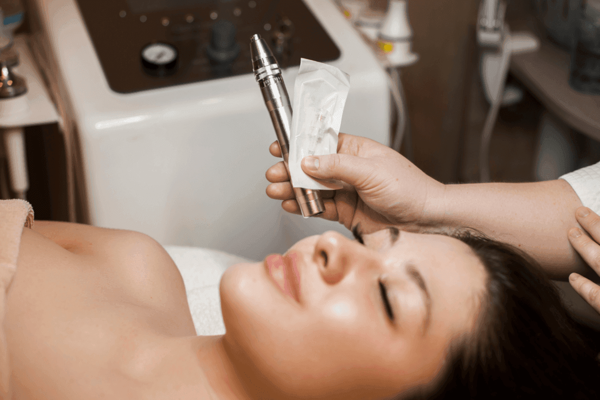 woman getting a microneedling treatment