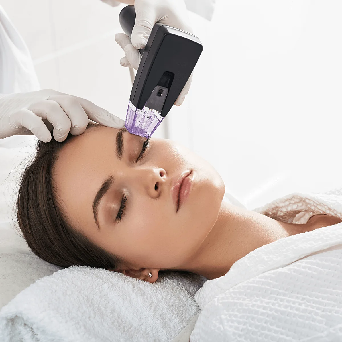 RF microneedling treatment