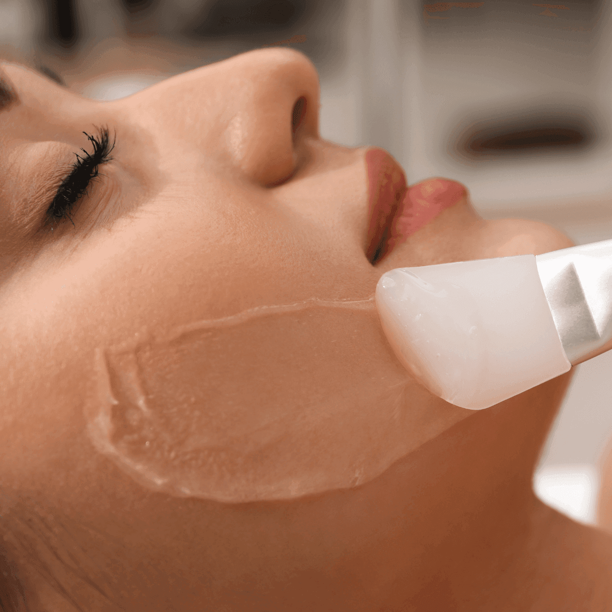woman getting a chemical peel treatment