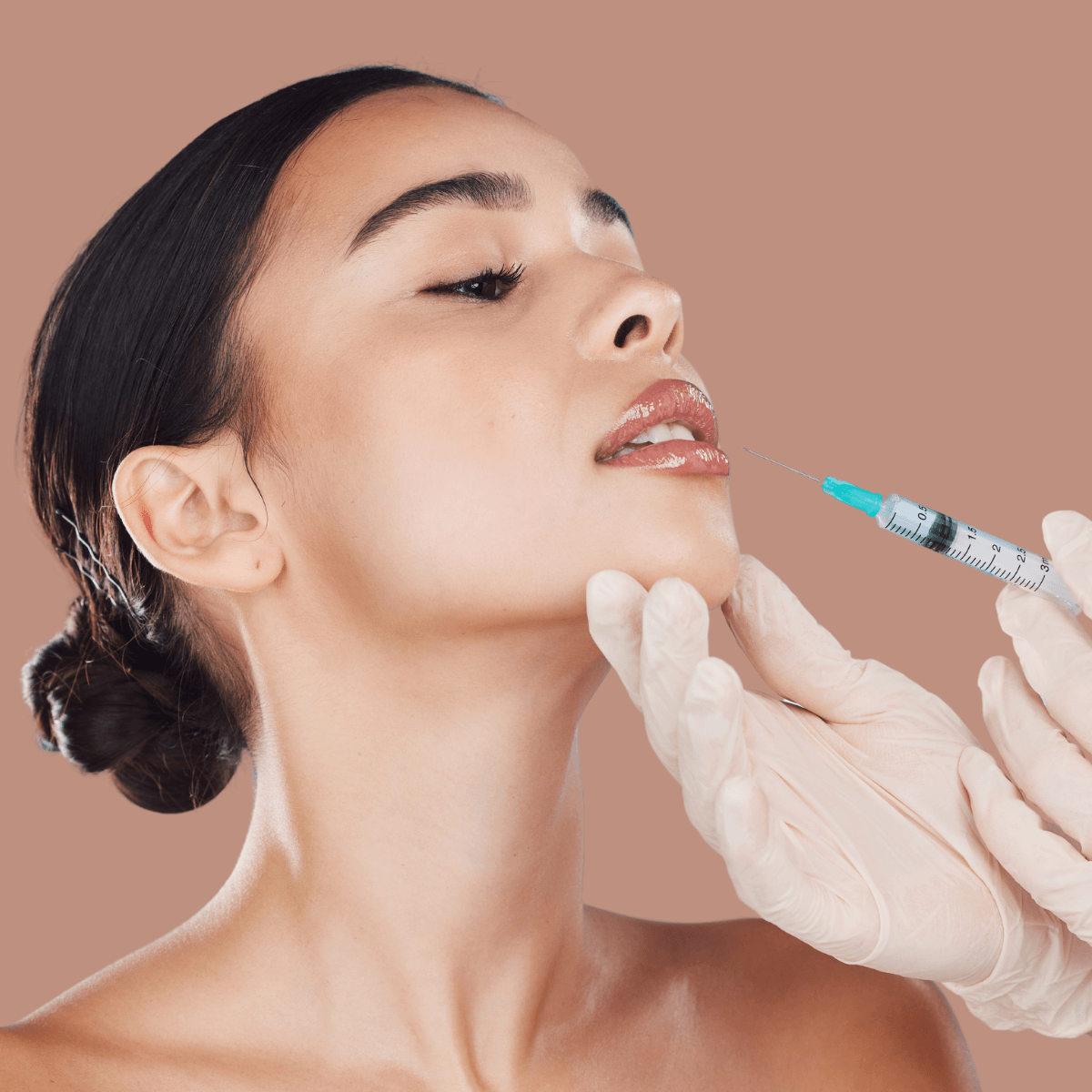 a woman getting hyaluronic lip fillers injected