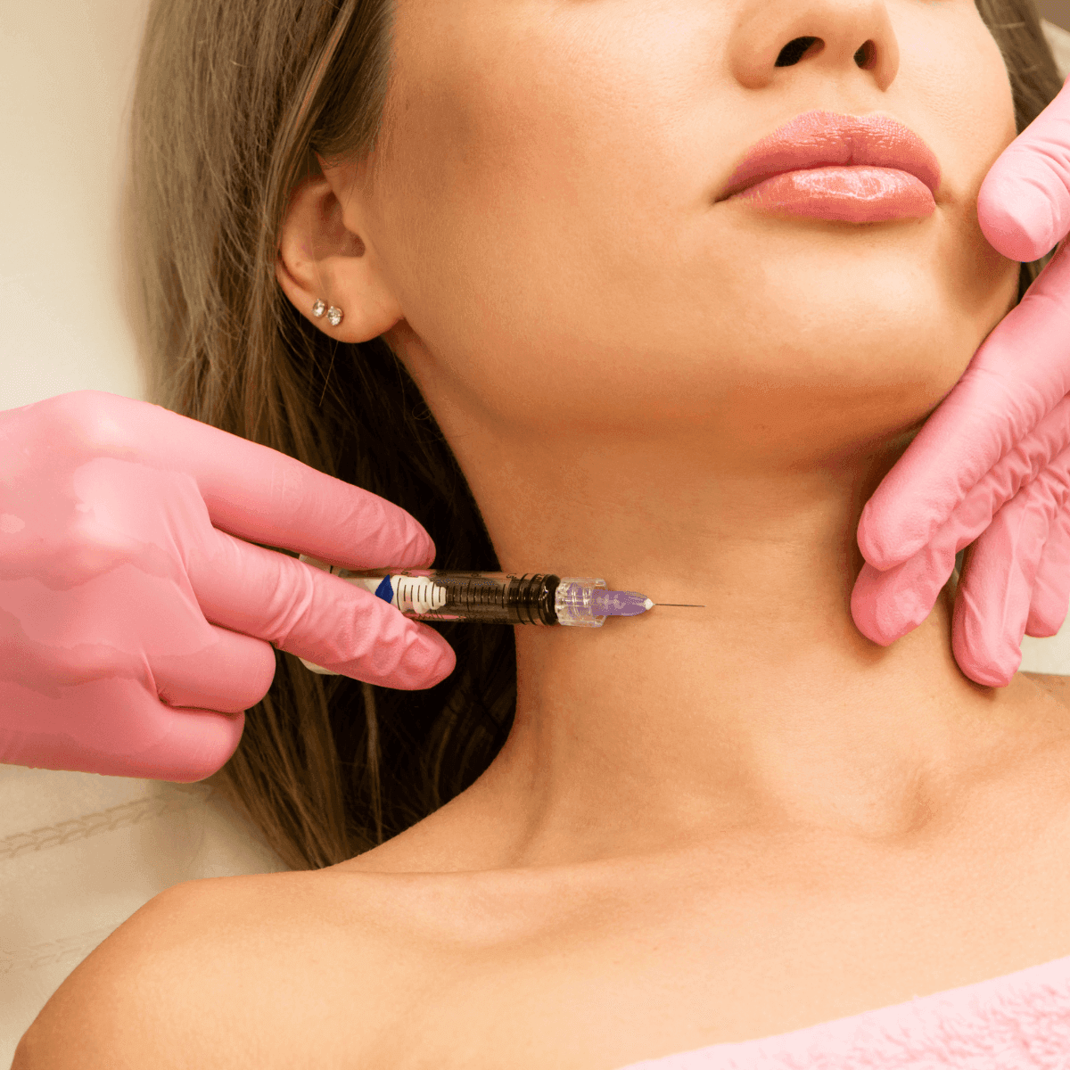 neck rejuvenation with fillers
