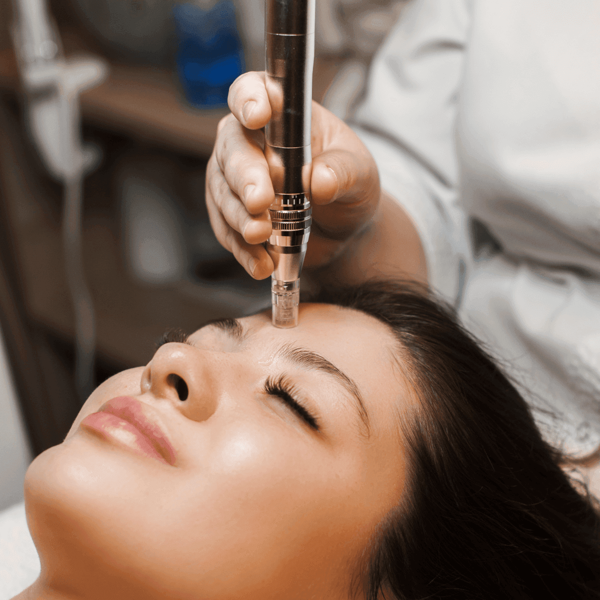 woman getting a microneedling treatment
