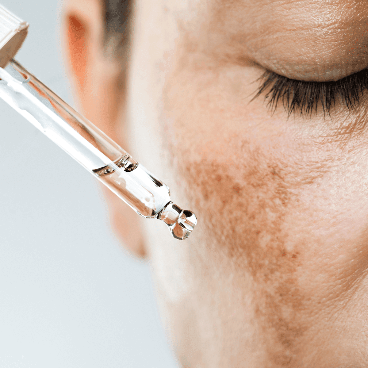 woman with hyperpigmentation applying serum