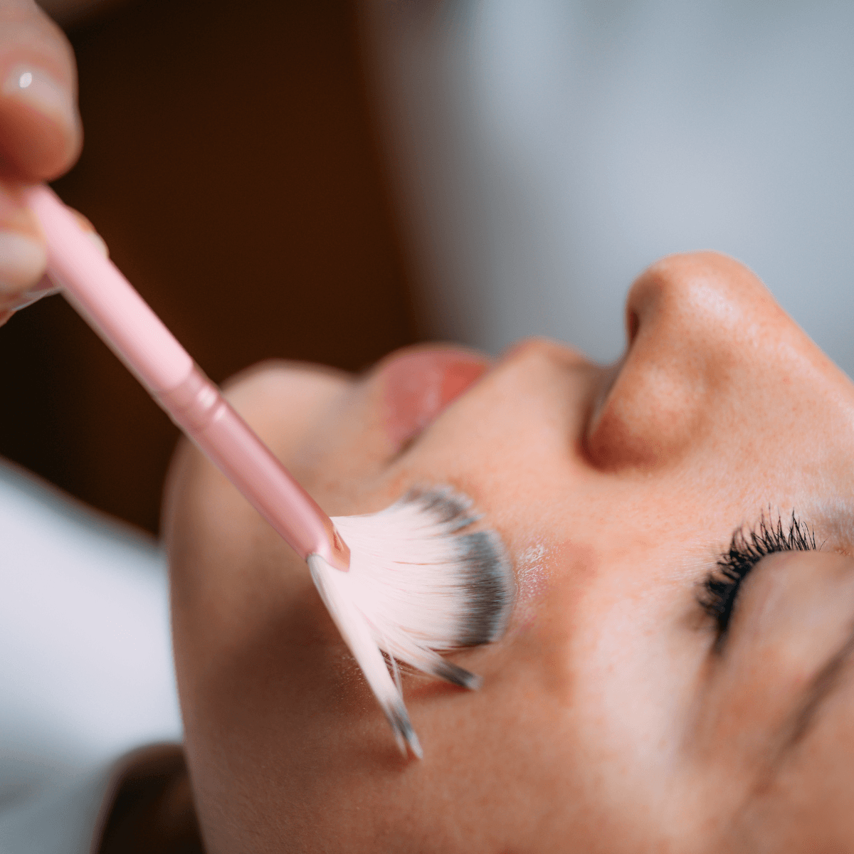 hyperpigmentation treatment