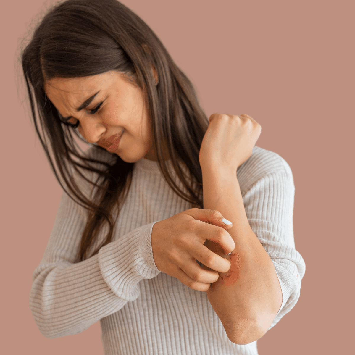 woman with seasonal eczema