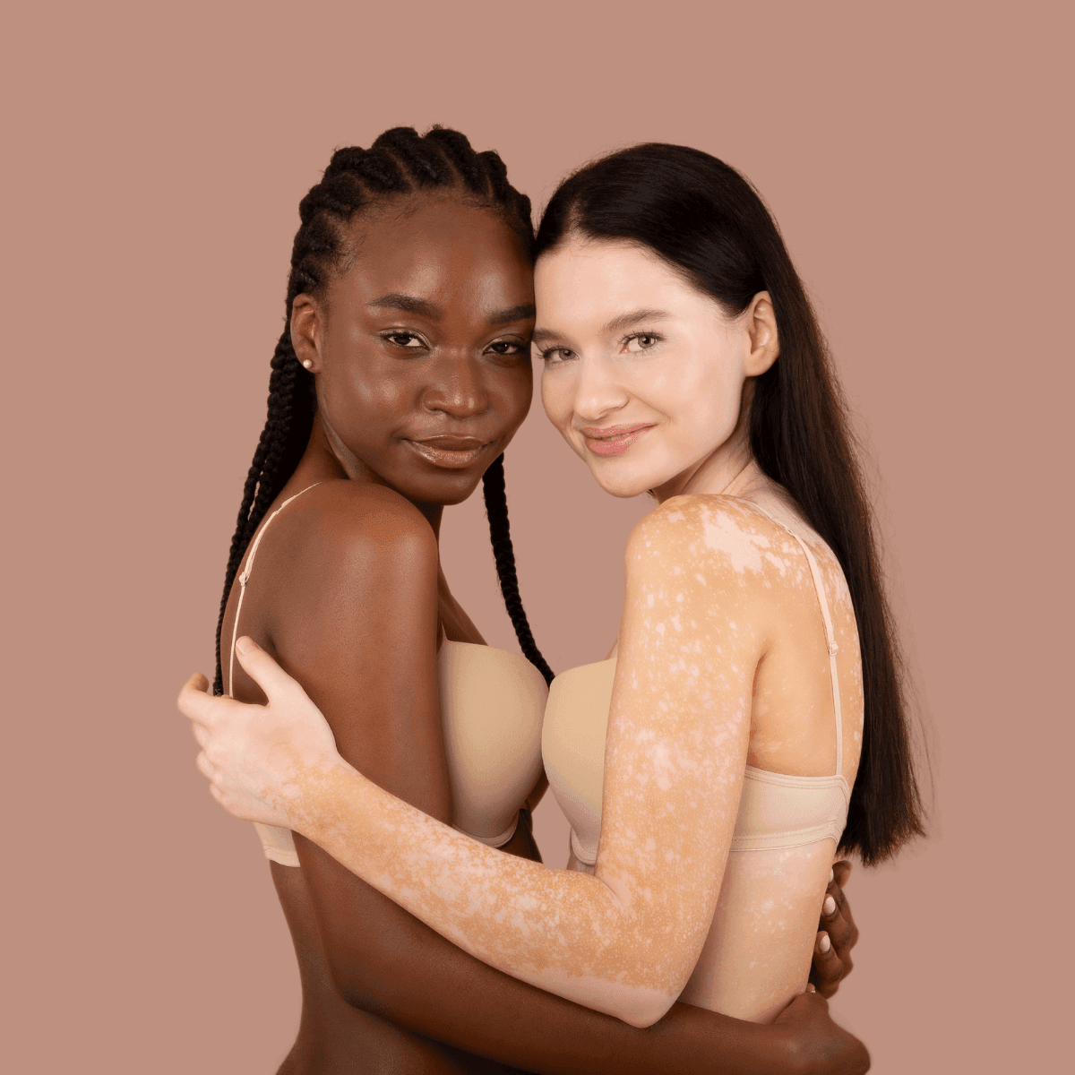 women with vitiligo