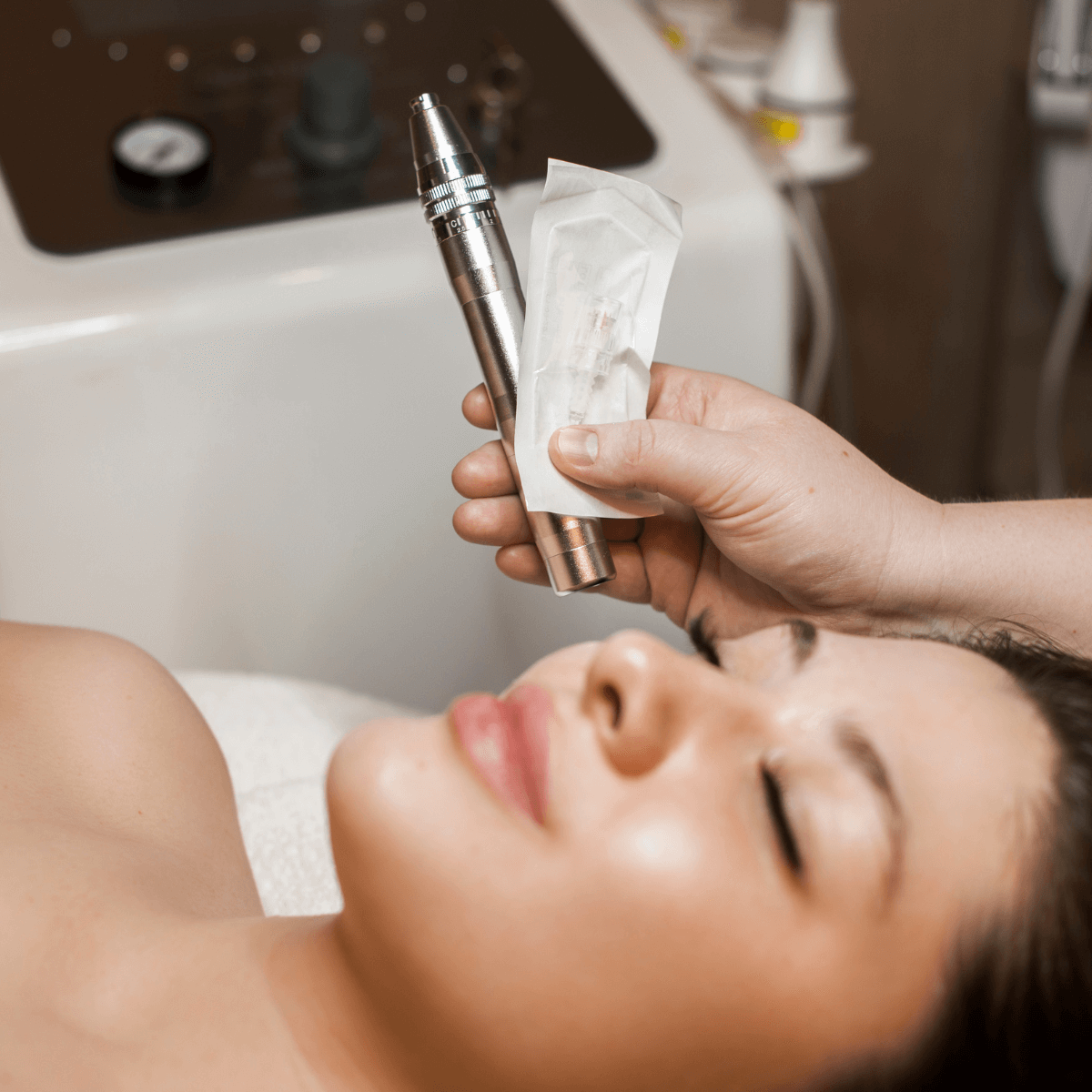 microneedling treatment