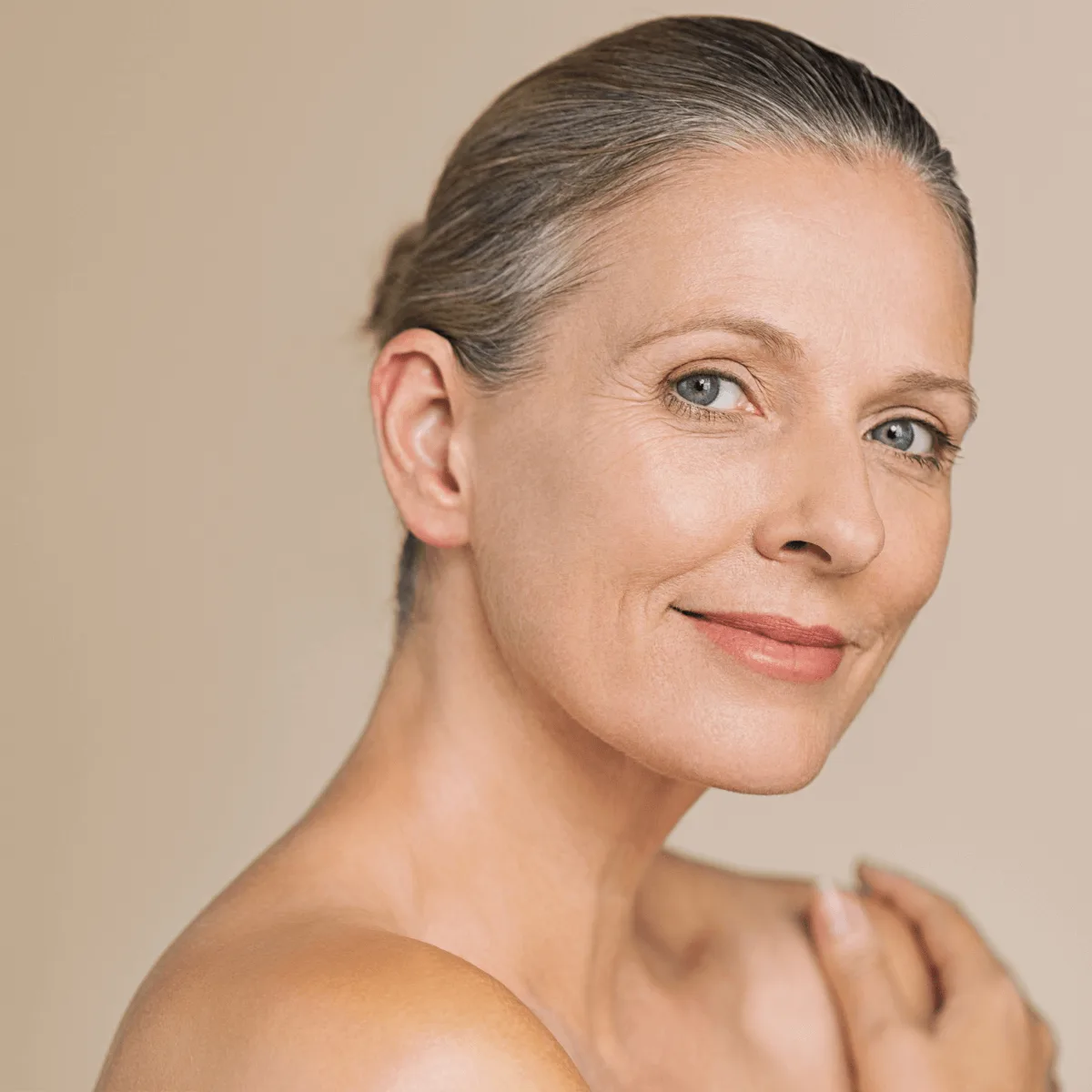 woman with signs of photoaging 