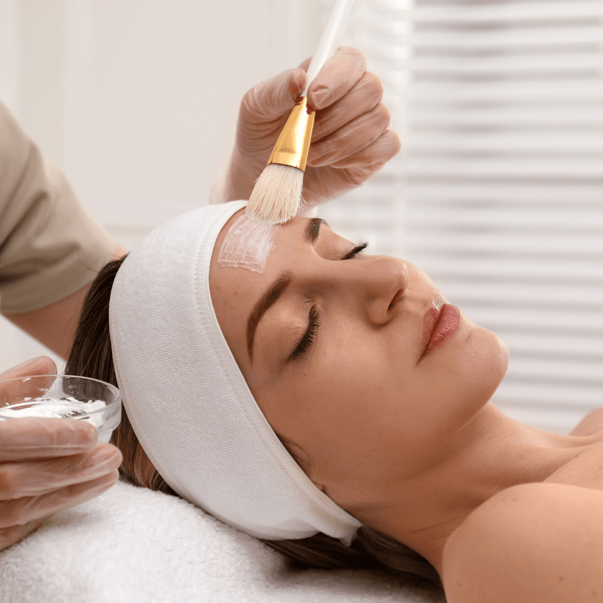 chemical peel treatment