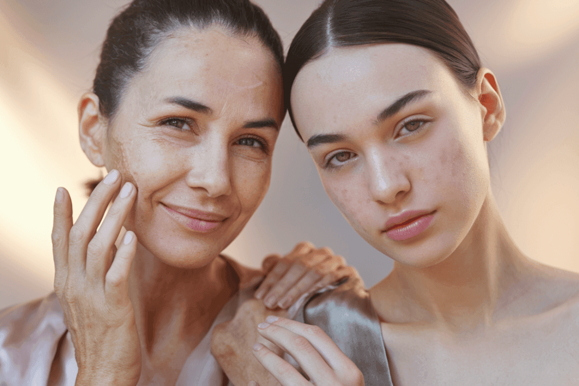 A photo of two women representing different skin care needs. The first woman, aged 30-35, has visible signs of photoaging, such as wrinkles, spots, and roughness on her facial skin. She is wearing a soft-colored outfit and has a radiant, uniform, and rejuvenated skin. The second woman, aged 25-30, has acne vulgar, with a predominance of non-inflammatory papules and controlled oiliness