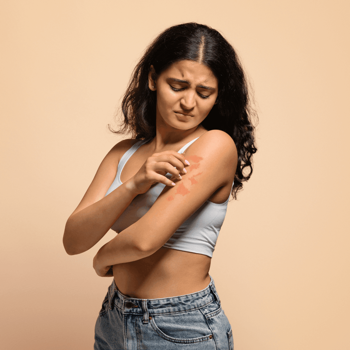 woman with psoriasis symptoms