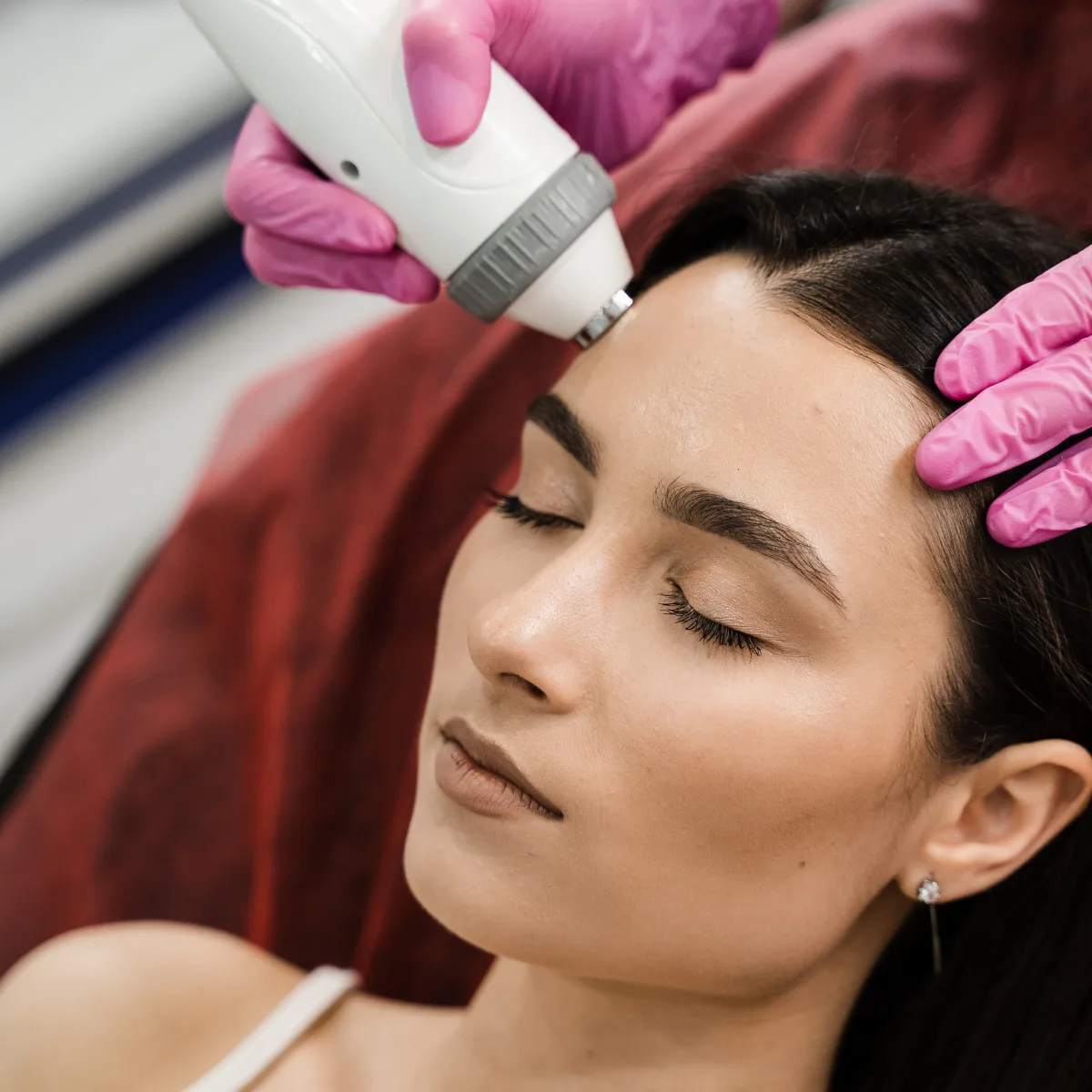 RF treatment for sagging skin prevention