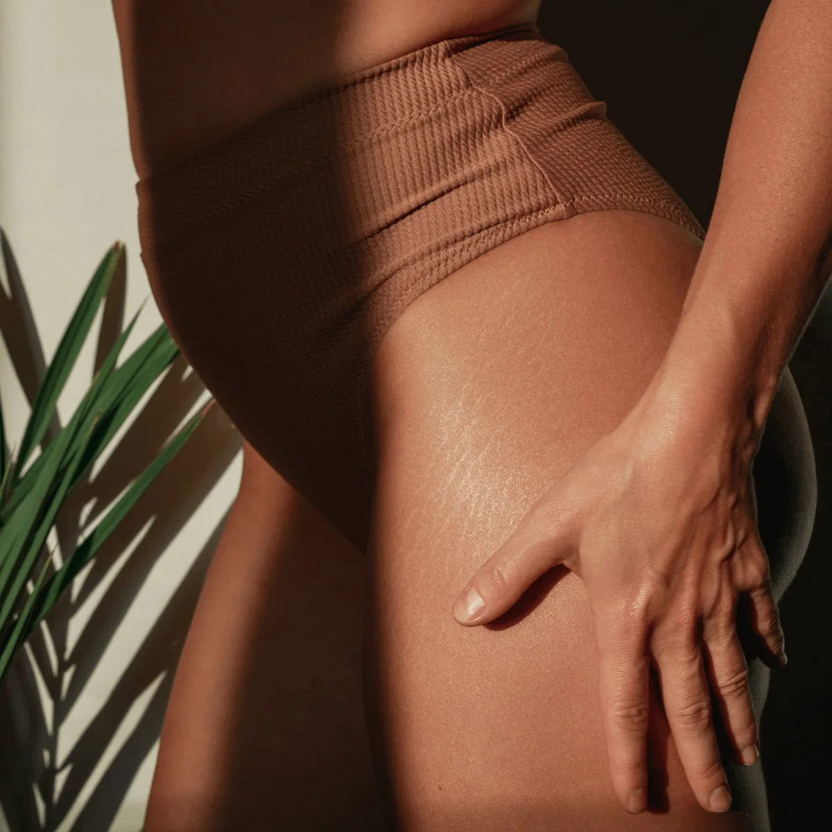 woman with stretch marks