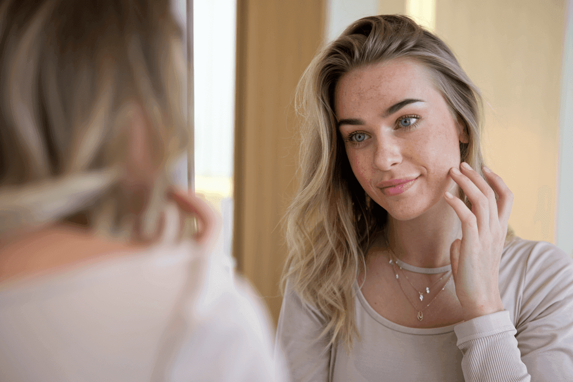 woman with blue eyes, wearing a light-colored top and a delicate necklace, looking in the mirror. She has a Seborrheic Dermatitis.