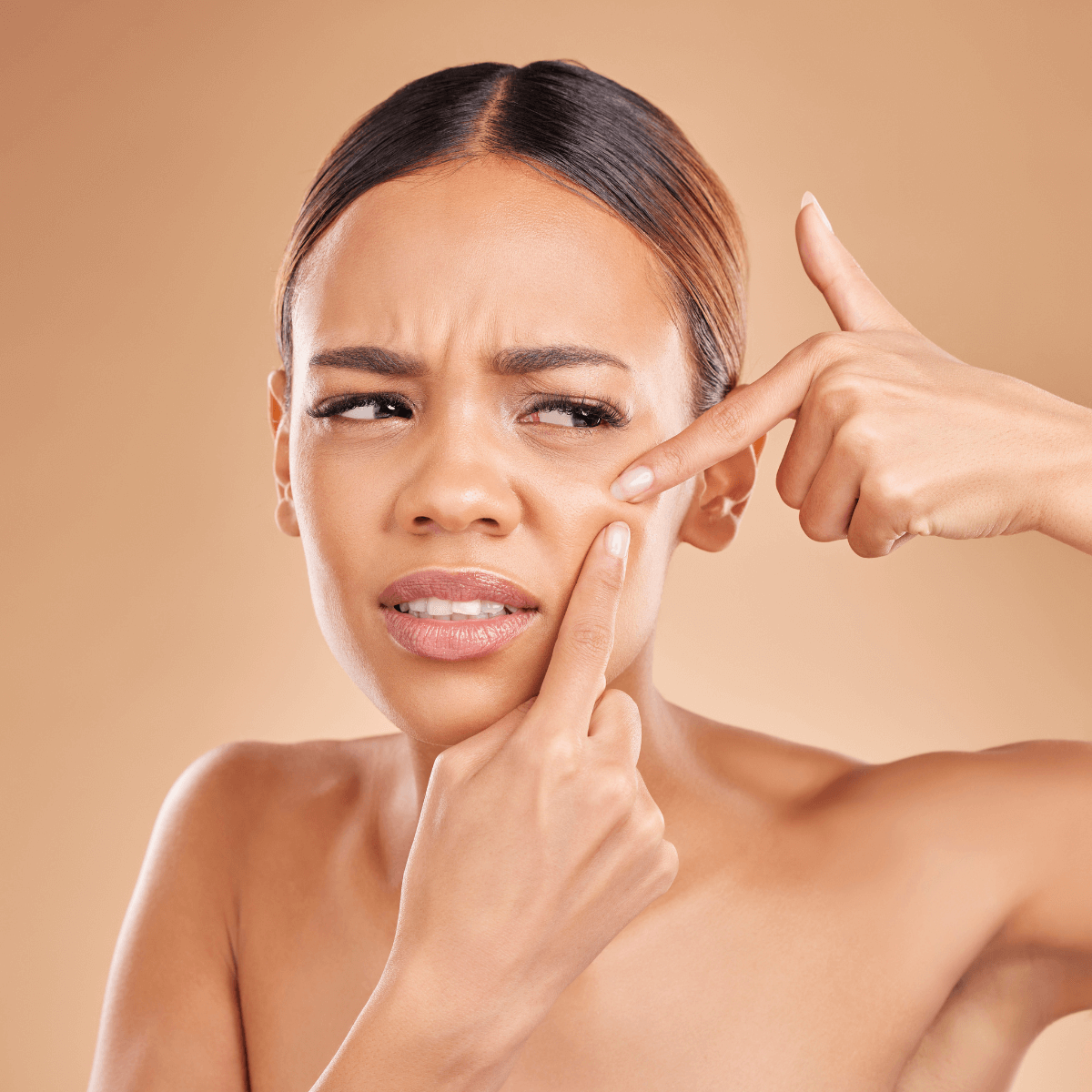 woman with blackheads 
